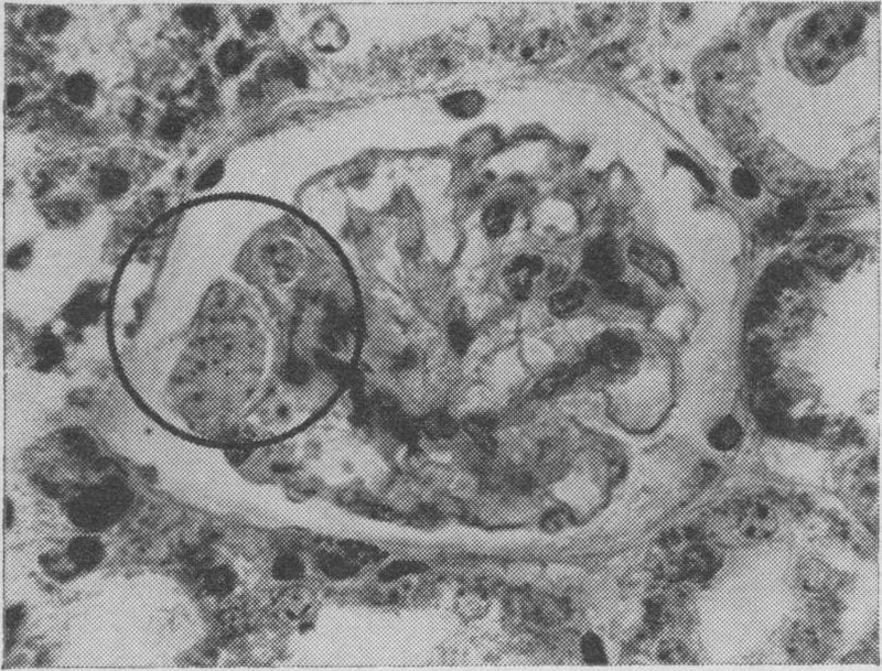 klossiella muris (schizogonia, veseglomerulus)